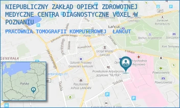 PRACOWNIA TOMOGRAFII KOMPUTEROWEJ - NIEPUBLICZNY ZAKŁAD OPIEKI ZDROWOTNEJ MEDYCZNE CENTRA DIAGNOSTYCZNE VOXEL W POZNANIU - UL. IGNACEGO PADEREWSKIEGO 5,  ŁAŃCUT
