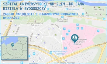 ZAKŁAD RADIOLOGII I DIAGNOSTYKI OBRAZOWEJ - SZPITAL UNIWERSYTECKI NR 2 IM. DR JANA BIZIELA W BYDGOSZCZY - UJEJSKIEGO 75,  BYDGOSZCZ
