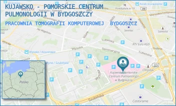 PRACOWNIA TOMOGRAFII KOMPUTEROWEJ - KUJAWSKO - POMORSKIE CENTRUM PULMONOLOGII W BYDGOSZCZY - SEMINARYJNA 1,  BYDGOSZCZ