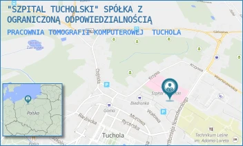 PRACOWNIA TOMOGRAFII KOMPUTEROWEJ - "SZPITAL TUCHOLSKI" SPÓŁKA Z OGRANICZONĄ ODPOWIEDZIALNOŚCIĄ - NOWODWORSKIEGO 14-18,  TUCHOLA
