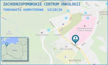 TOMOGRAFIA KOMPUTEROWA - ZACHODNIOPOMORSKIE CENTRUM ONKOLOGII - STRZAŁOWSKA 22,  SZCZECIN
